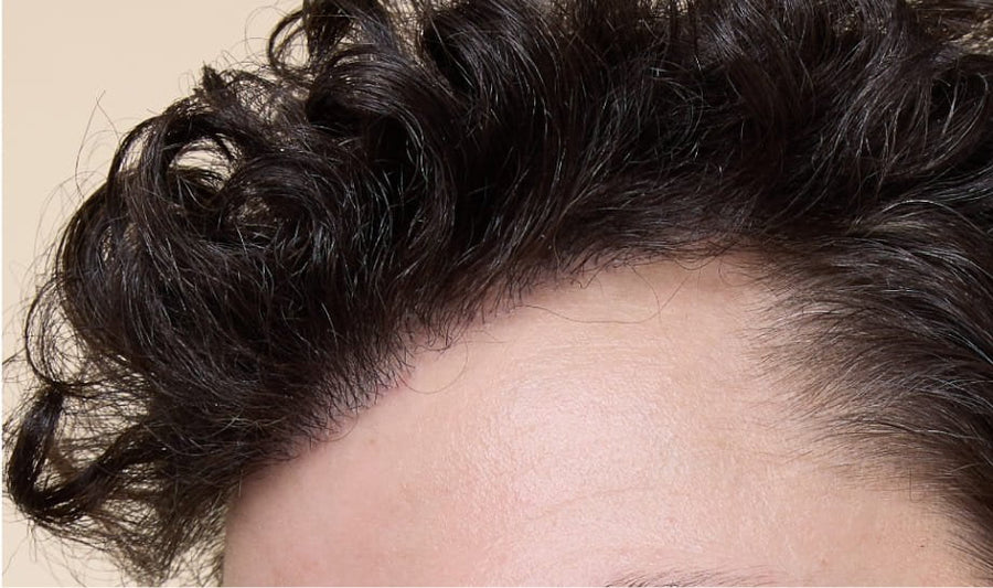 Scalp Love
